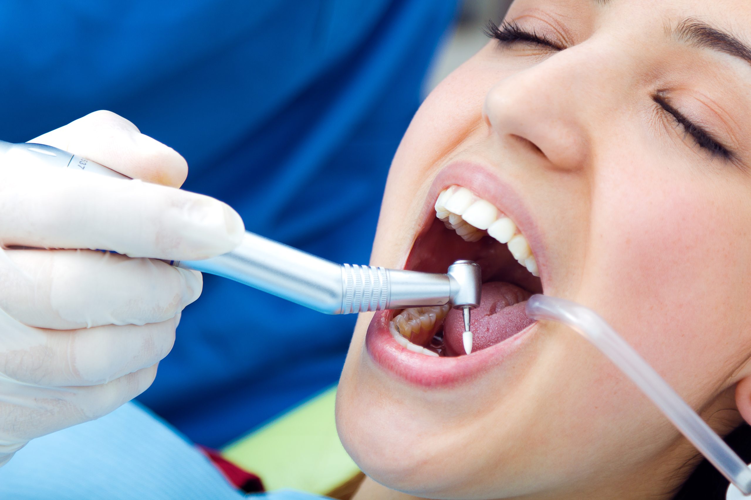 Cute young woman at the dentist. Mouth checkup