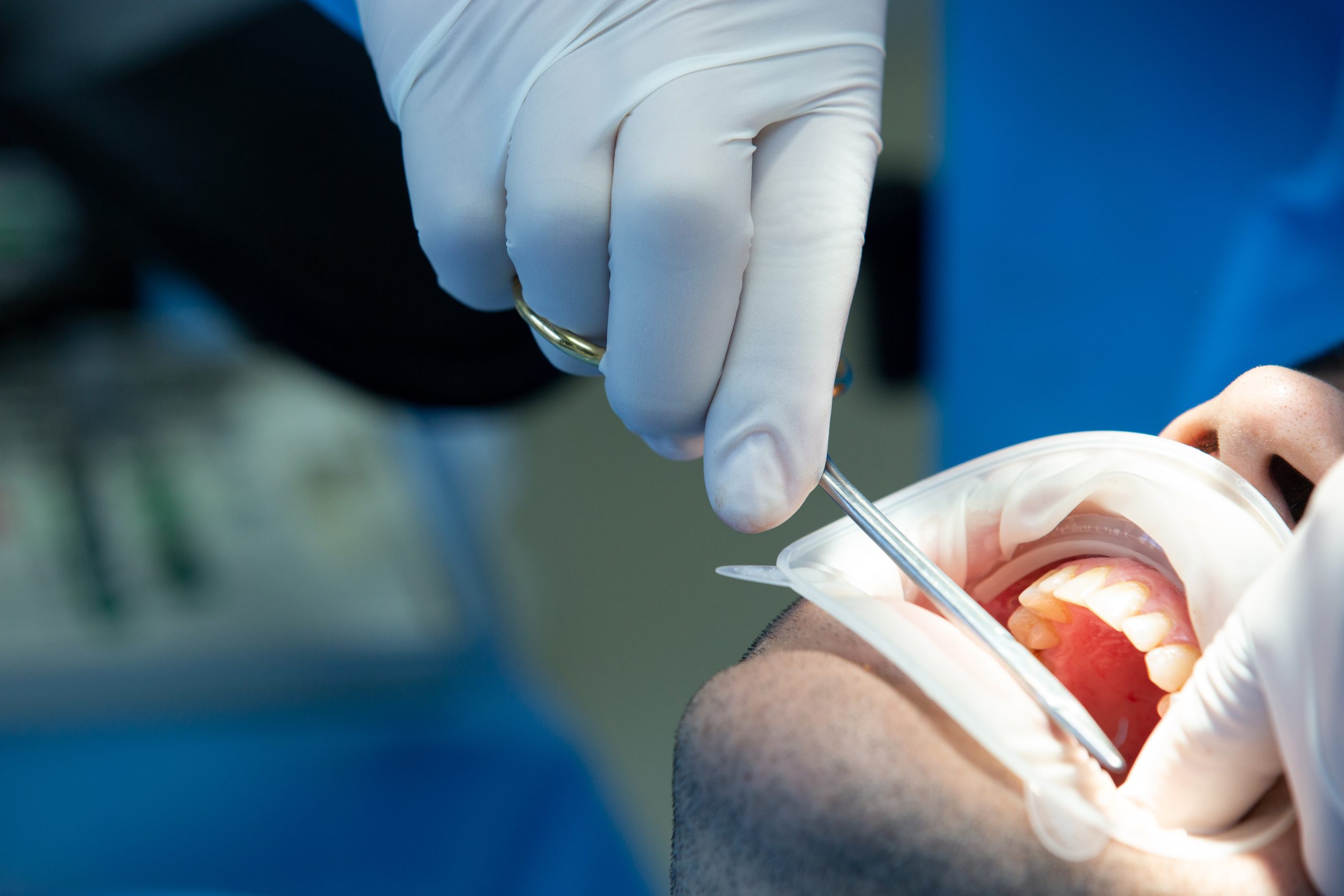 dentist with tool makes some manipulations in the patient’s mouth