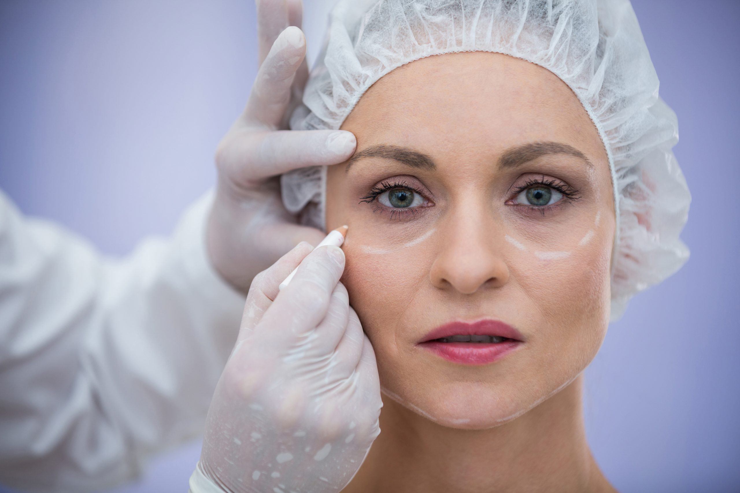 Close-up of doctor marking female patients face for cosmetic treatment