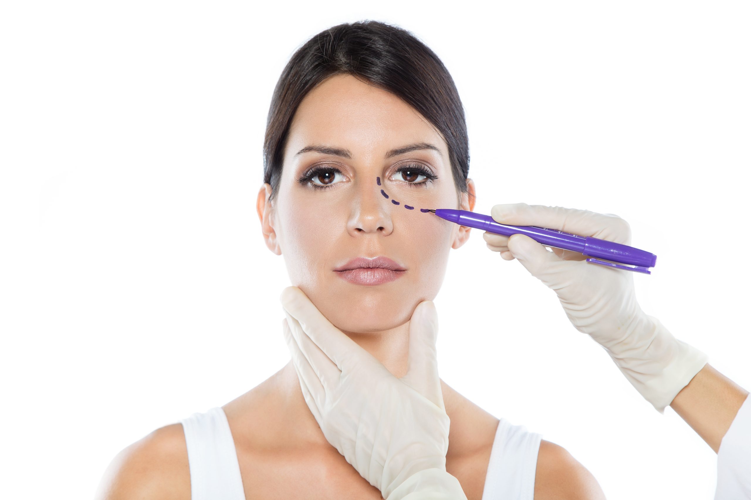 Plastic surgeon drawing dashed lines on her patient’s face.