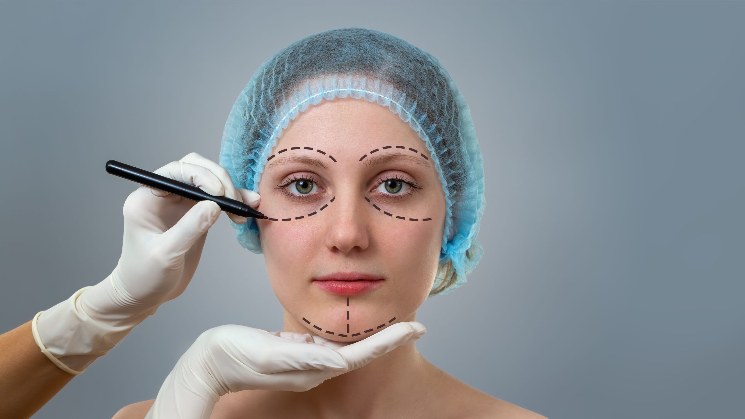 Plastic surgeon drawing lines on a face of young woman prior to cosmetic surgery